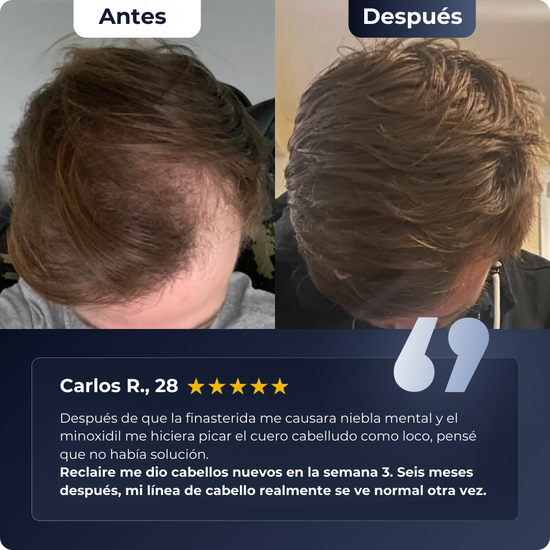 RenovaHair Roll-On