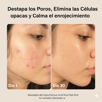 Dúo de dosis de arroz con ácido hipocloroso™