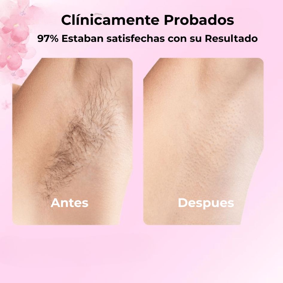 Aceite de Cyperus Rotundus de Caramela Beauty™