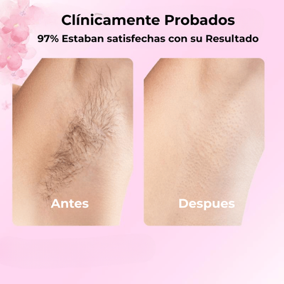 Aceite de Cyperus Rotundus de Caramela Beauty™